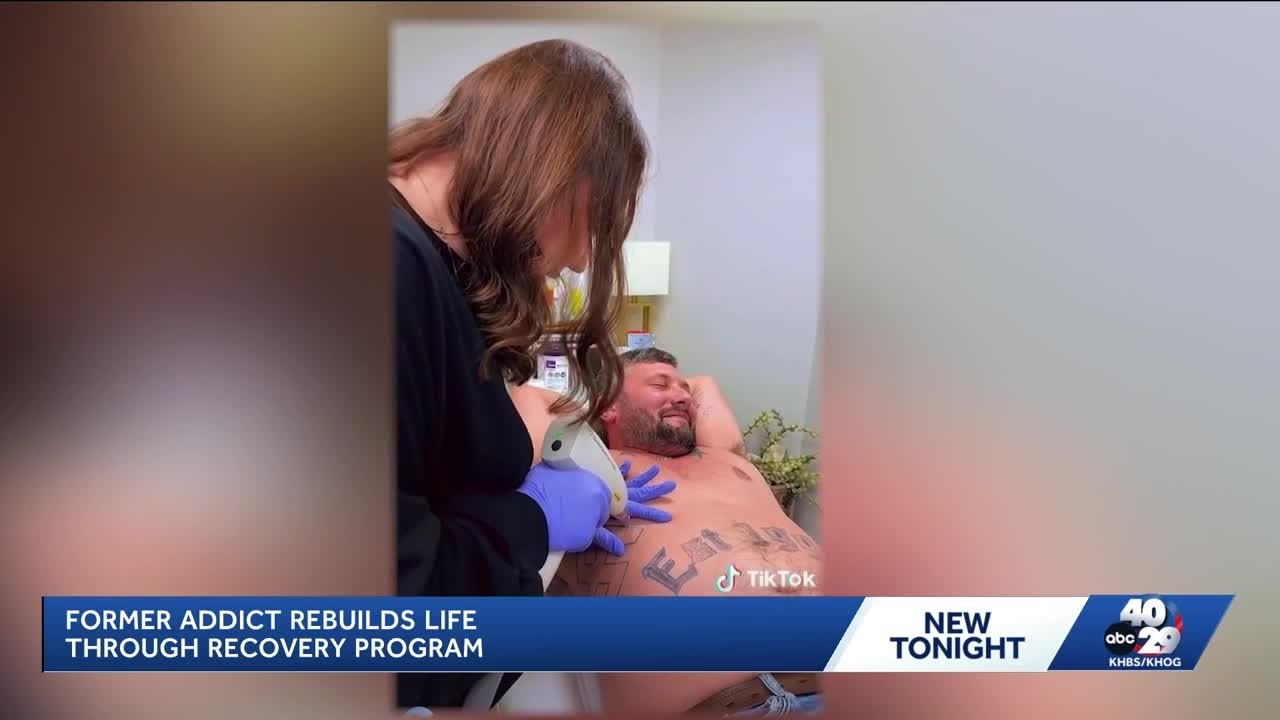 Clarksville man removes hate symbol tattoo in journey to recovery