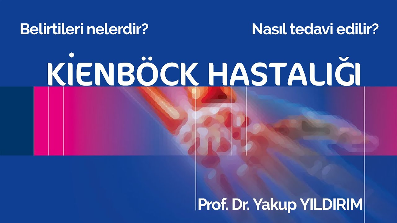 Kienböck hastalığı nedir? Belirtileri nelerdir? Nasıl tedavi edilir?