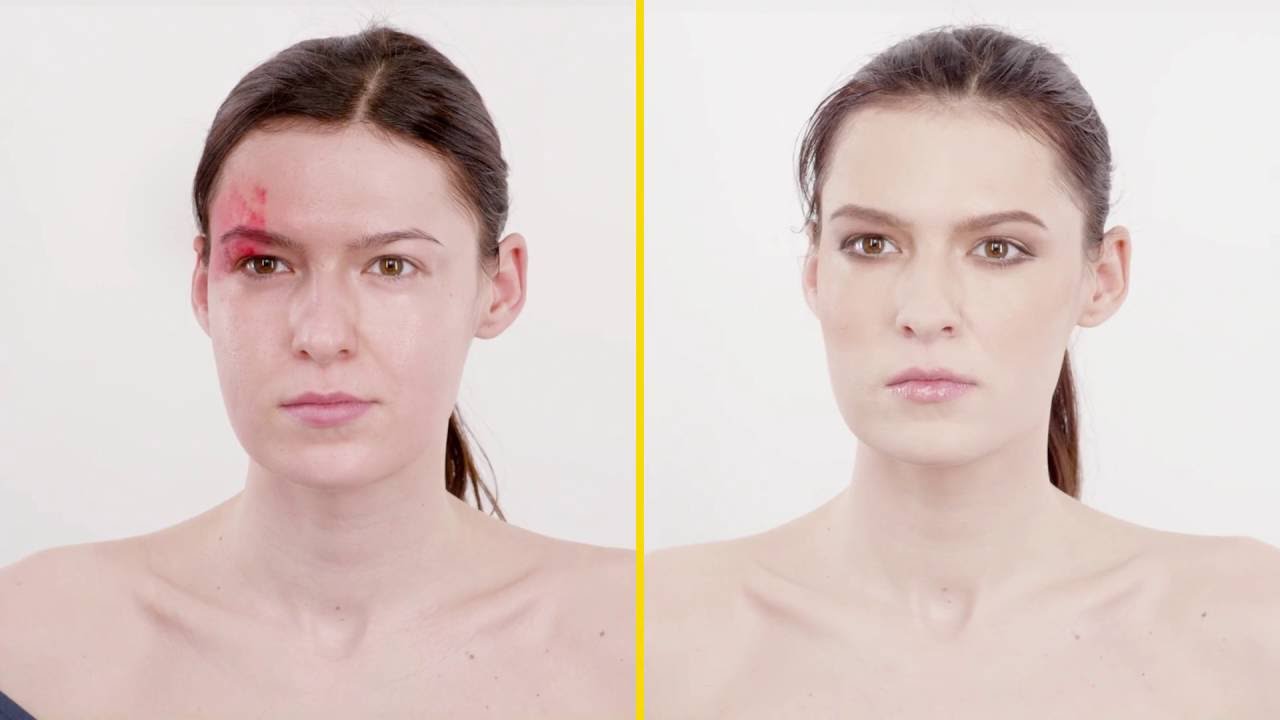 Come coprire angioma - RiparCover Camouflage