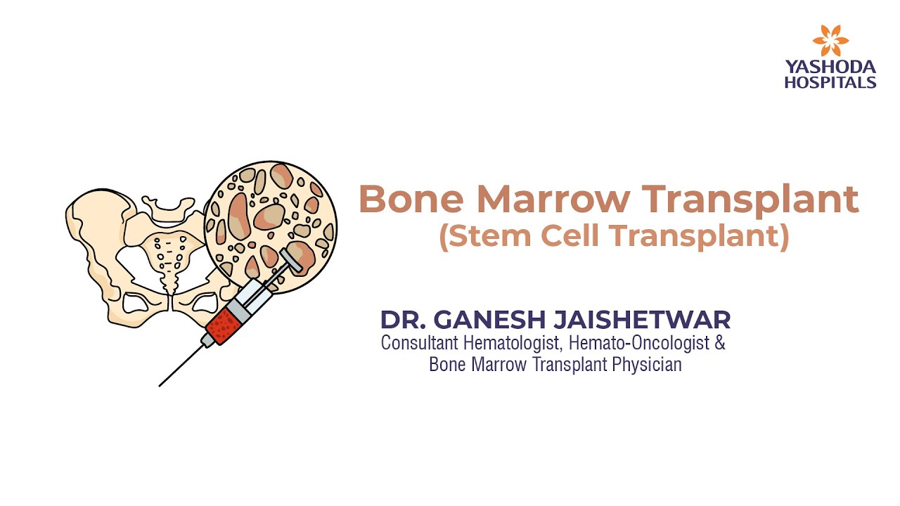 Bone Marrow Transplant | Stem Cell Transplant | Yashoda Hospitals Hyderabad