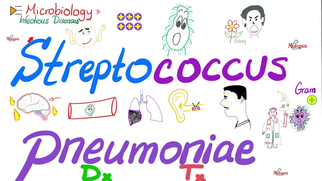 Streptococcus pneumoniae - Diagnosis & Treatment - Microbiology 🧫 & Infectious Diseases 🦠