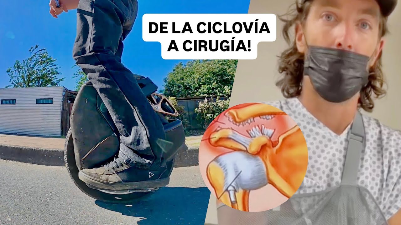 10.000KM+ en un Monociclo Eléctrico, Terminé en el Quirófano!