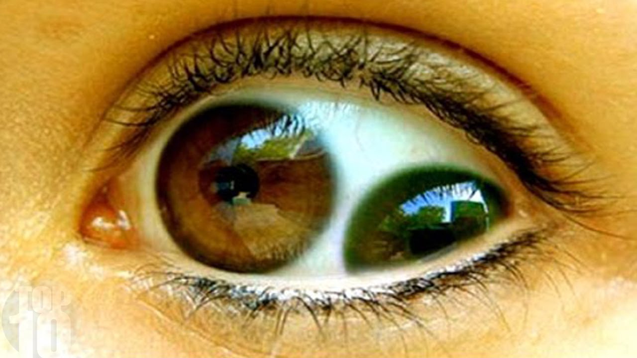 10 People with The Most Unusual Eyes