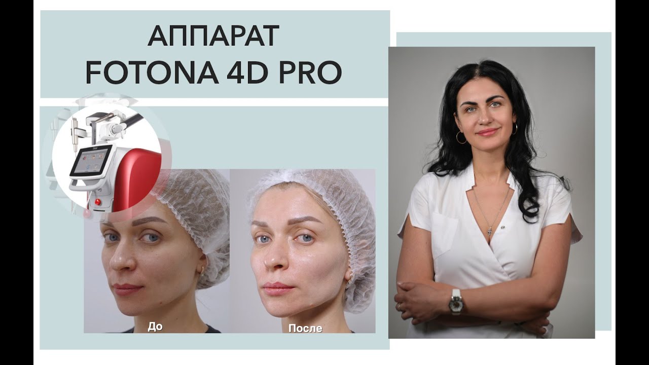 Процедуры на аппарате Fotona 4D Pro с косметологом Захаровой Анной