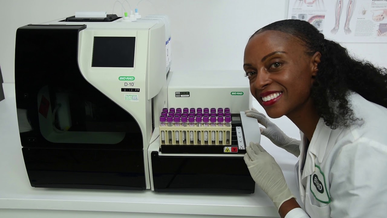 D-10 System -- Keeping HPLC Simple