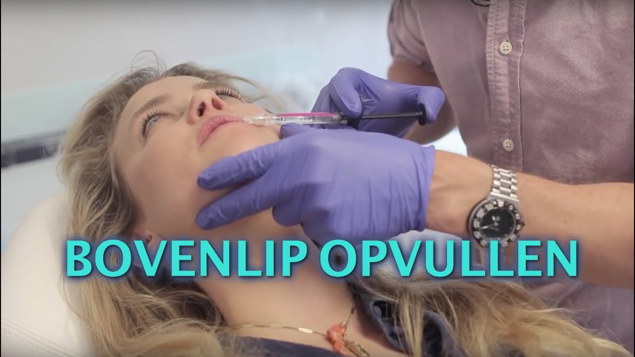 Bovenlip opvullen | FURROW.NL