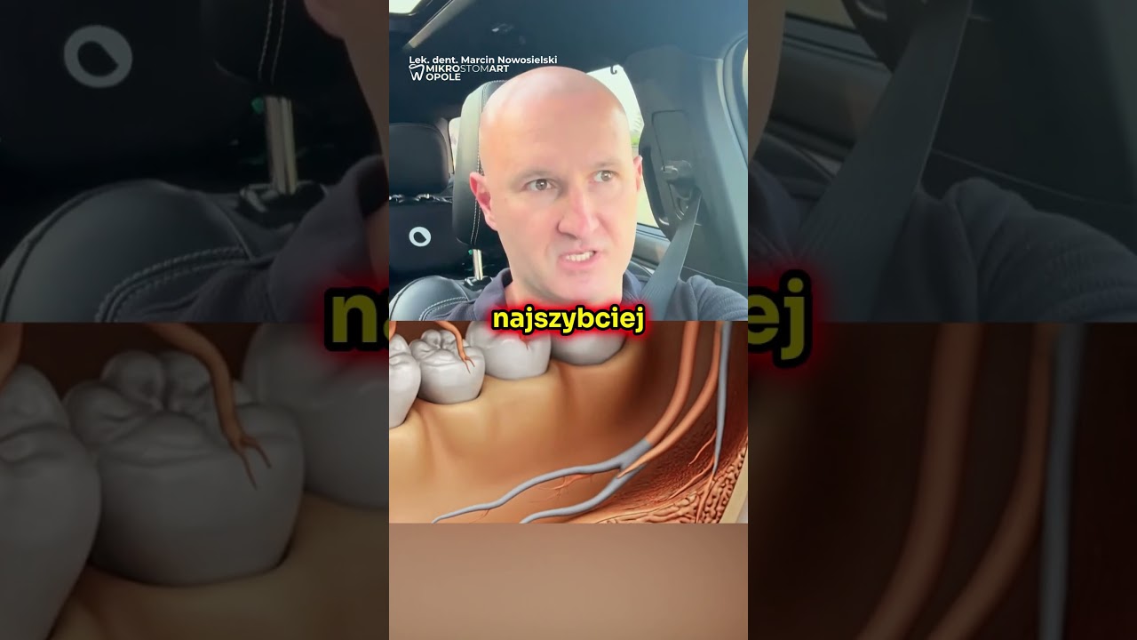 NERW ZĘBODOLOWY USZKODZONY? 🔌❌ Dentysta: NIE PANIKUJ! JEST SPOS&Oacute;B na SZYBKĄ REGENERACJĘ!