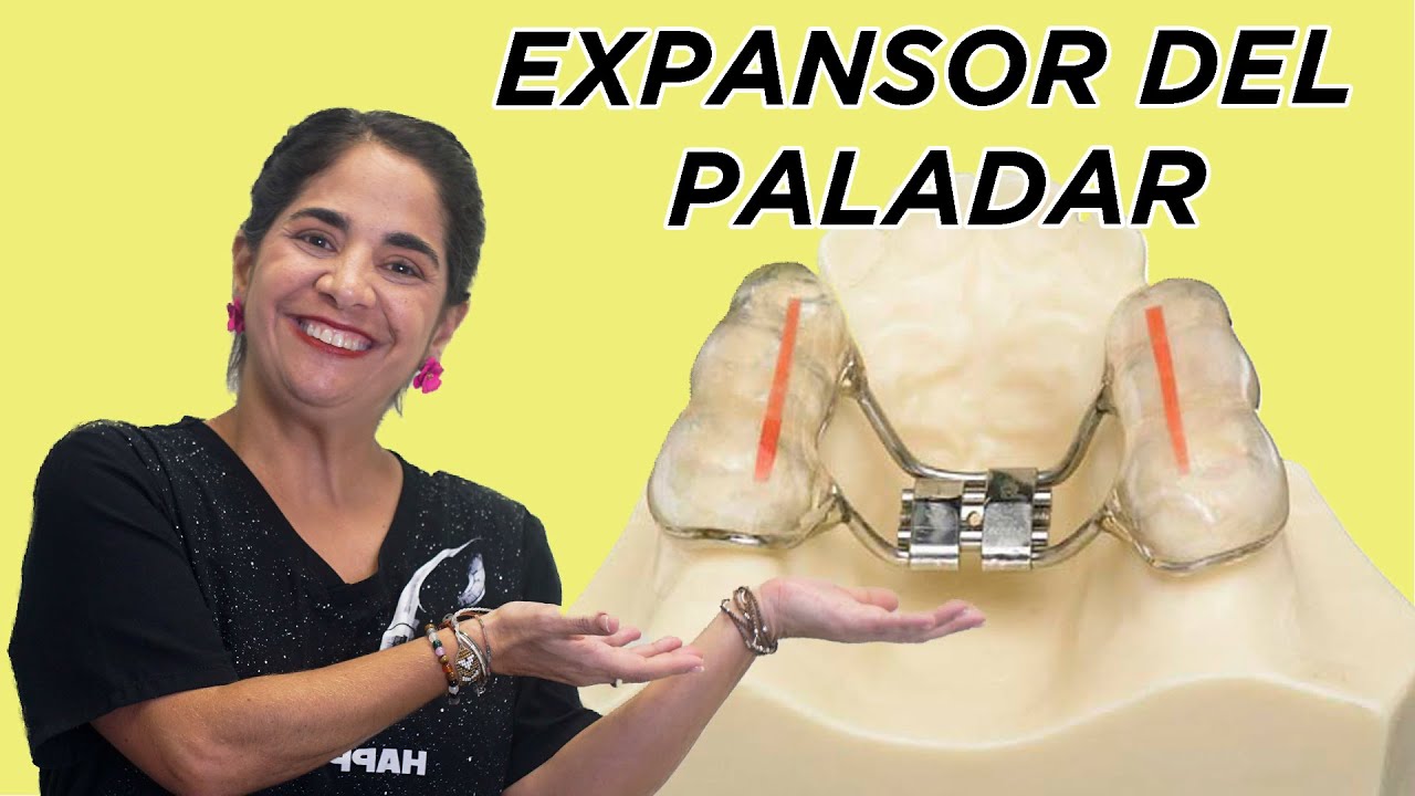 Expansor del paladar