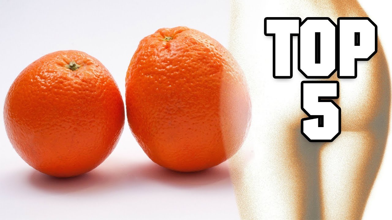 Was hilft gegen Cellulite | Zellulite bek&auml;mpfen | Prof. Ingo Frob&ouml;se