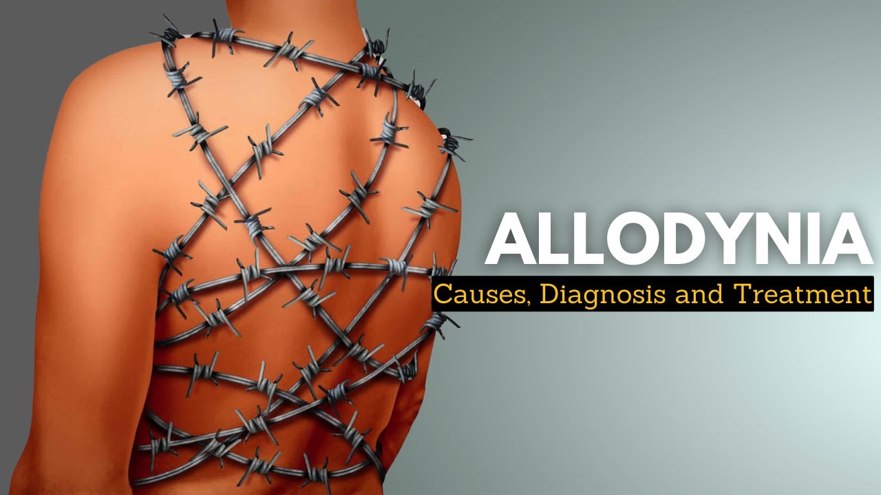 Living with Allodynia: Tips for Coping and Alleviating Unbearable Pain