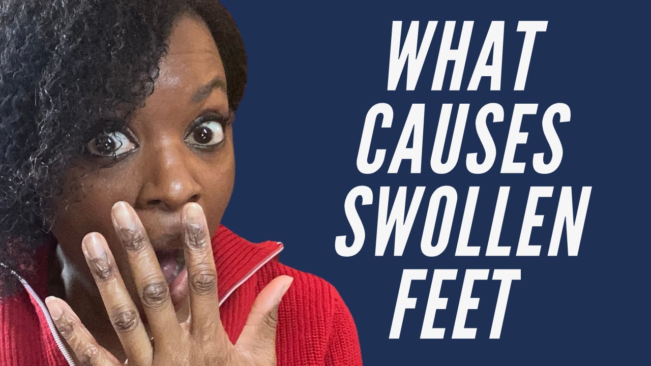 Causes of swollen feet