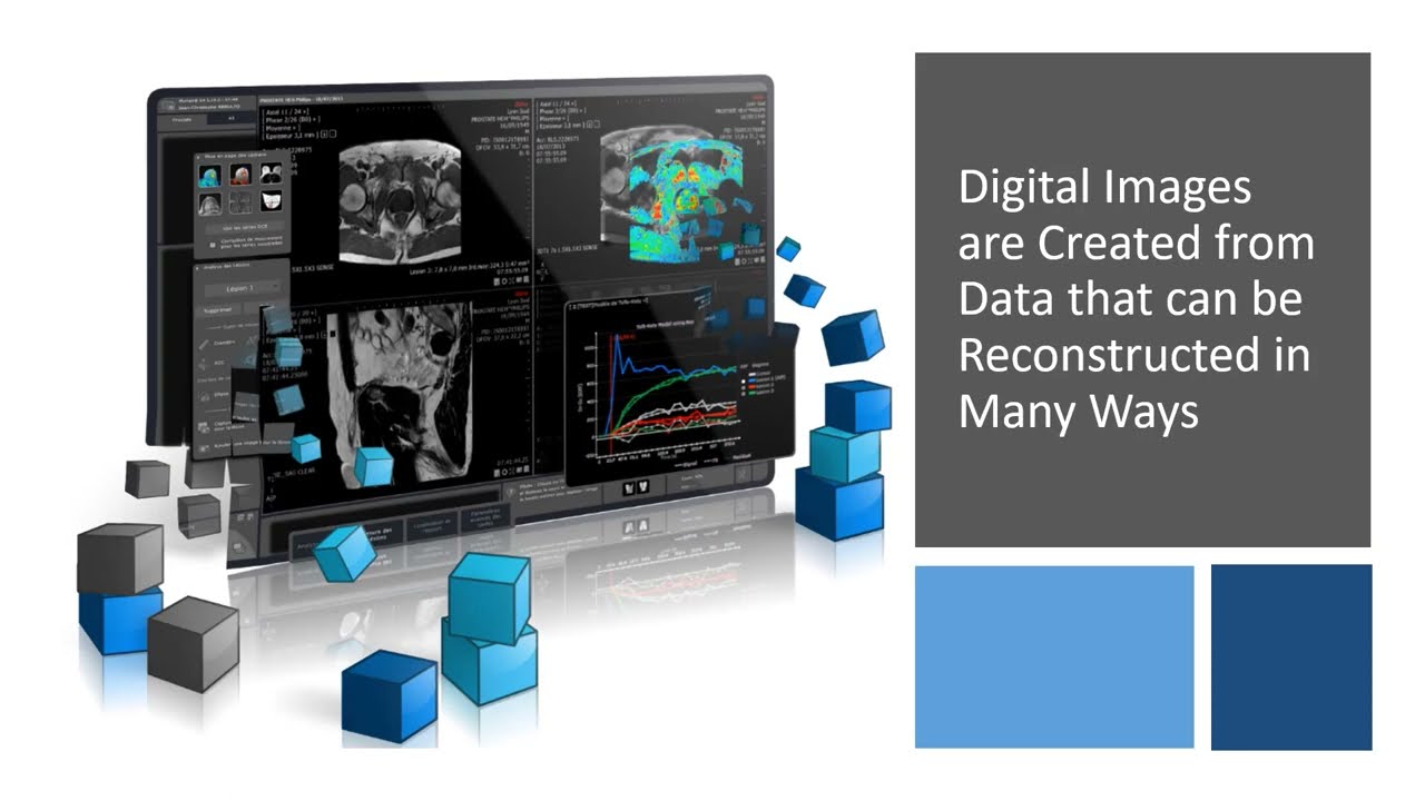 Digital X-ray Creating Medical Images