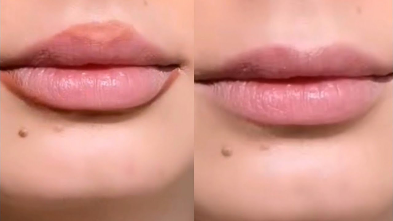 طريقة تكبير الشفايف الصغيرة ومساحة ذقنها صغيرة ✨ نور شرف