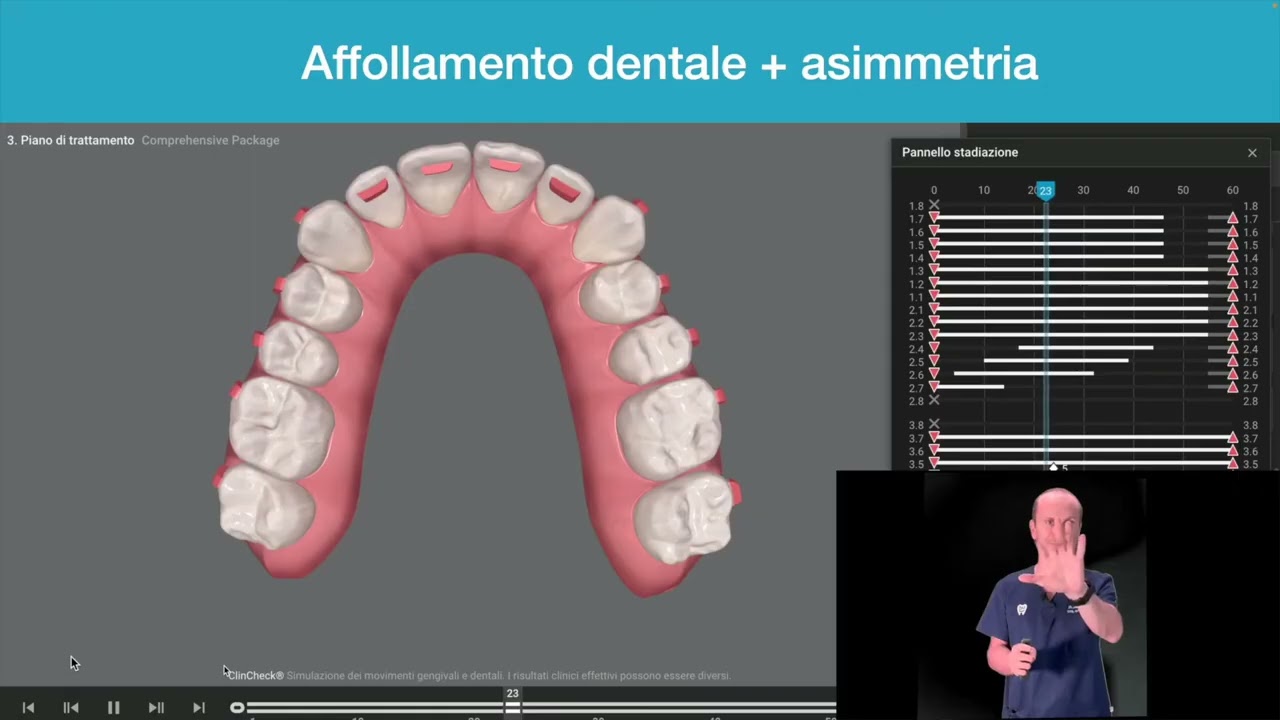 🇬🇧Adult Teeth Alignment