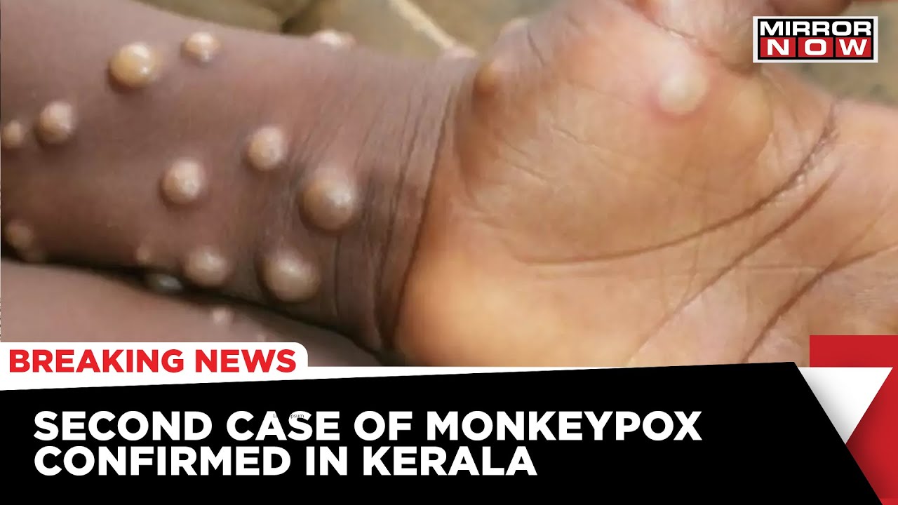 Strict Screening At Airports & Ports In State | 2nd Monkeypox Case In Kerala | Breaking News