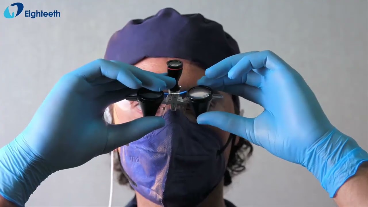 Using Eighteeth surgical loupes 𝐁𝐫𝐢𝐥𝐥𝐢𝐚𝐧𝐜𝐞 with surgical headlight 𝐒𝐨𝐟𝐭𝐨𝐮𝐜𝐡 by 𝐃𝐫. 𝐑𝐢𝐜𝐜𝐚𝐫𝐝𝐨 𝐓𝐨𝐧𝐢𝐧𝐢