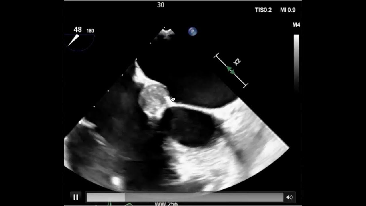 Echo Potpourri 2025: Lessons from Interesting Cases