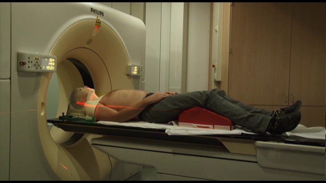 Radiotherapie Radboudumc