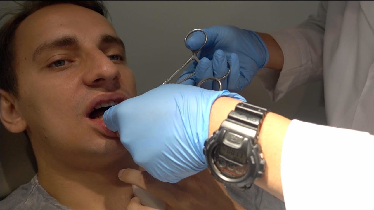 MY WIRES ARE TAKEN OUT!!!