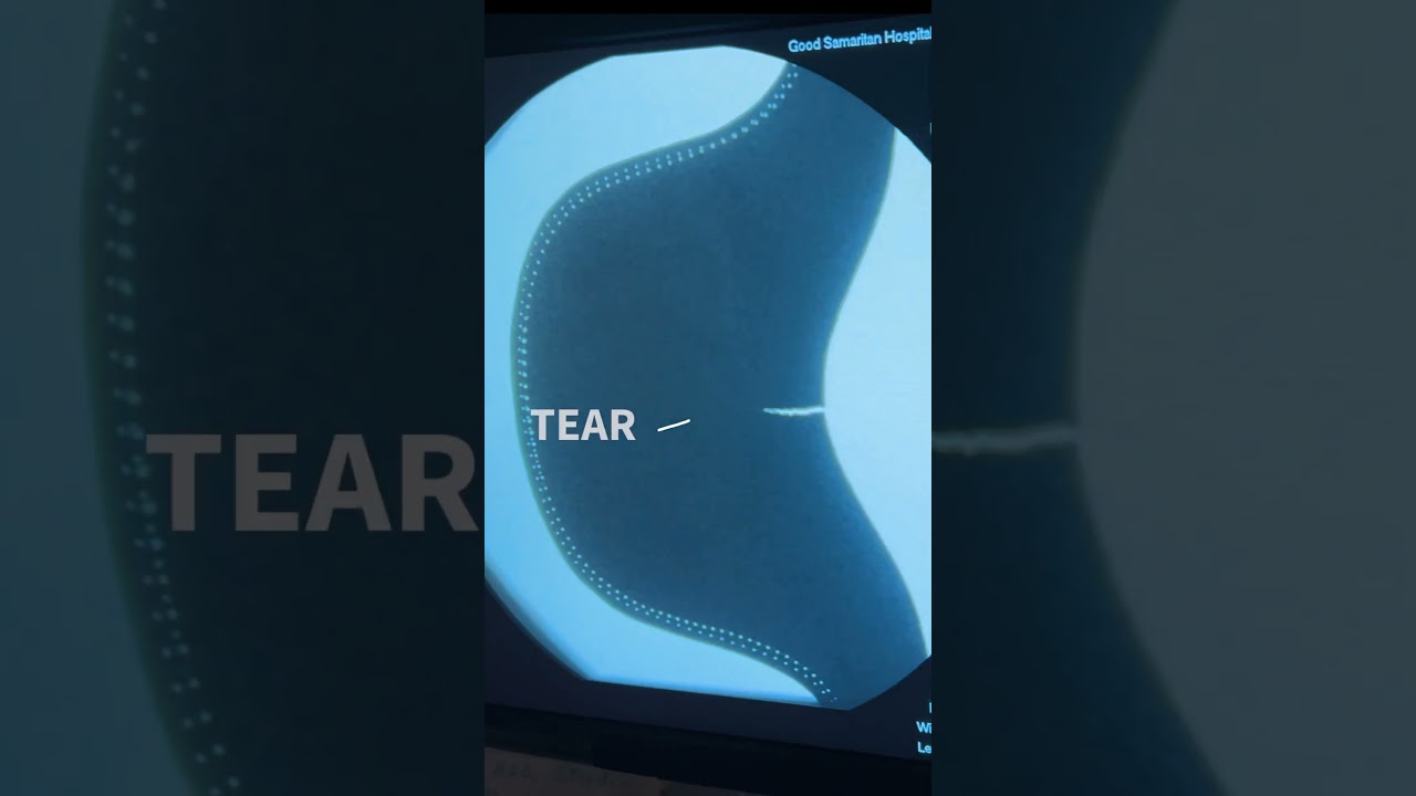 It’s all about proper protection: X-ray edition!