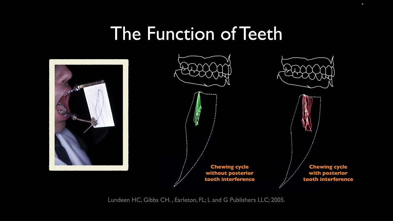 Anterior guidance