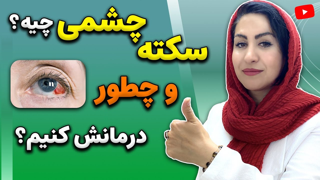 سکته چشمی چیست؟ | علل، روش های پیشگیری و درمان سکته چشم با این راهکارهای طبیعی