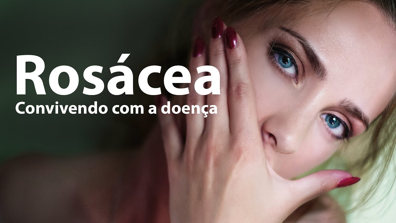 Rosácea | Experiências e dicas de quem convive com este problema de pele
