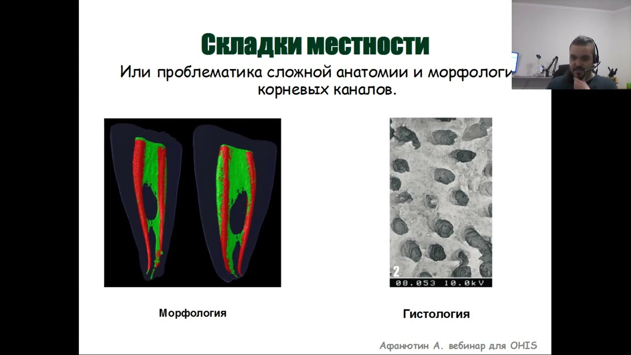 Вебинар №6 - Микробиология корневых каналов. Базовые  знания для успешного принятия решений.