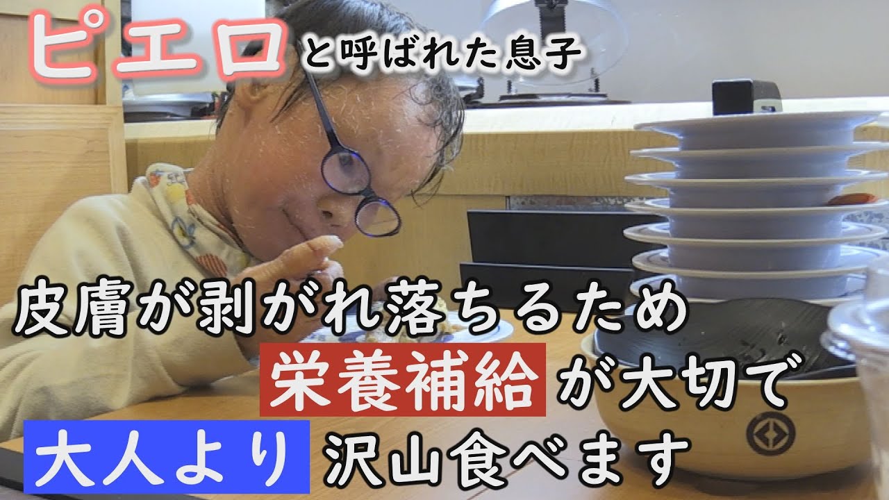 回転寿司で山積みの皿！いったい何皿食べたの？魚鱗癬は栄養補給が大切です…～定期配信型ドキュメンタリー「ピエロと呼ばれた息子」第９０話
