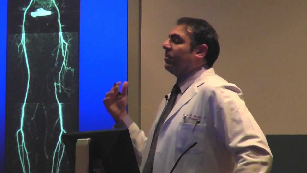 Health Matters: Leg Cramps or PAD? - ADC
