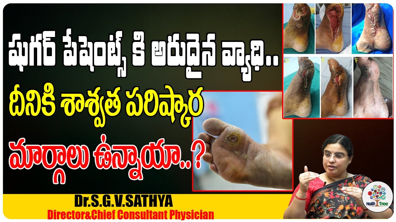 How To Naturally Prevent Diabetes | Health Tips | Dr. Sathya | Health tree