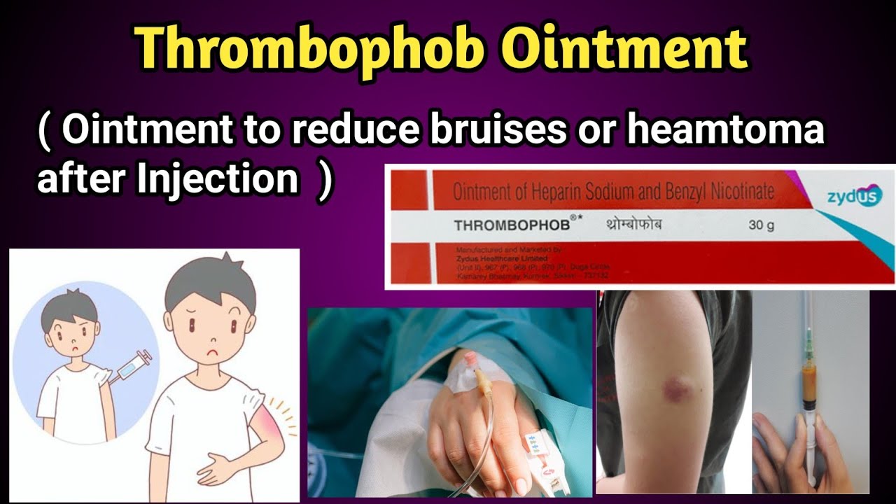 Thrombophob Ointment Uses and Side effects
