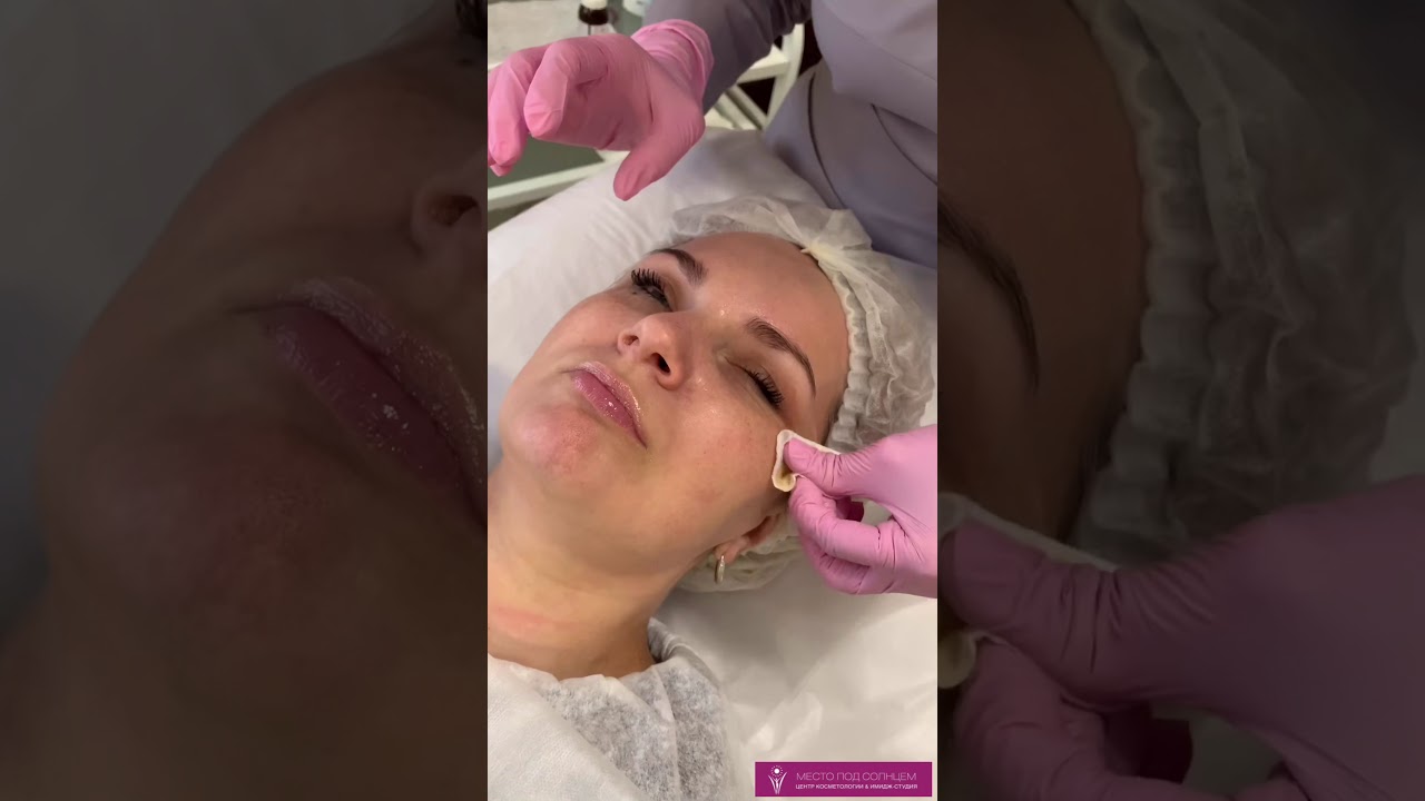 ПИЛИНГ MEDIDERMA FERULAC PEEL