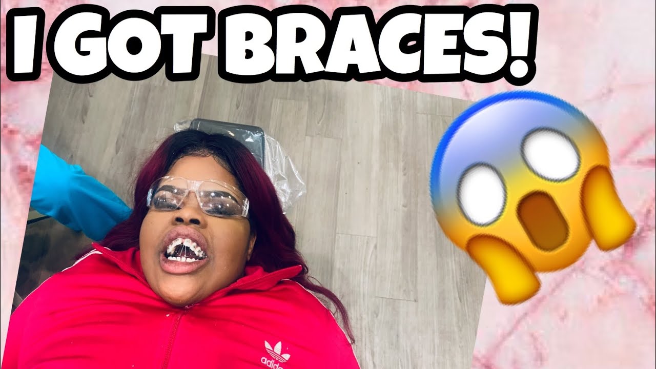 I GOT BRACES!😬| My JOURNEY