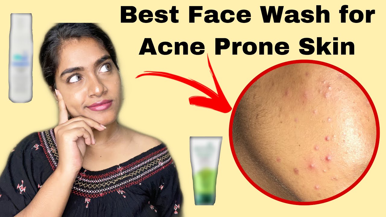 Best Face Washes for Acne prone skin | Affordable Face wash to control acne/pimples தமிழில்