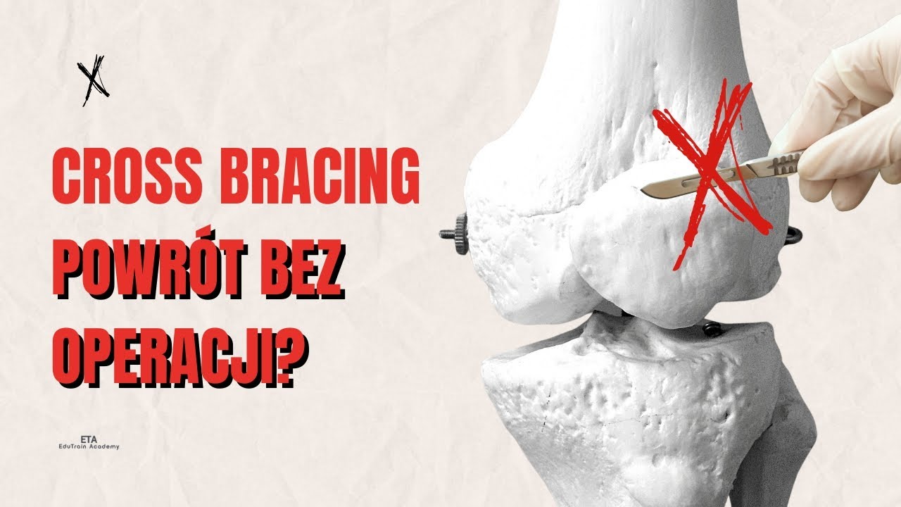 Cross Bracing Protocol- ACL bez operacji