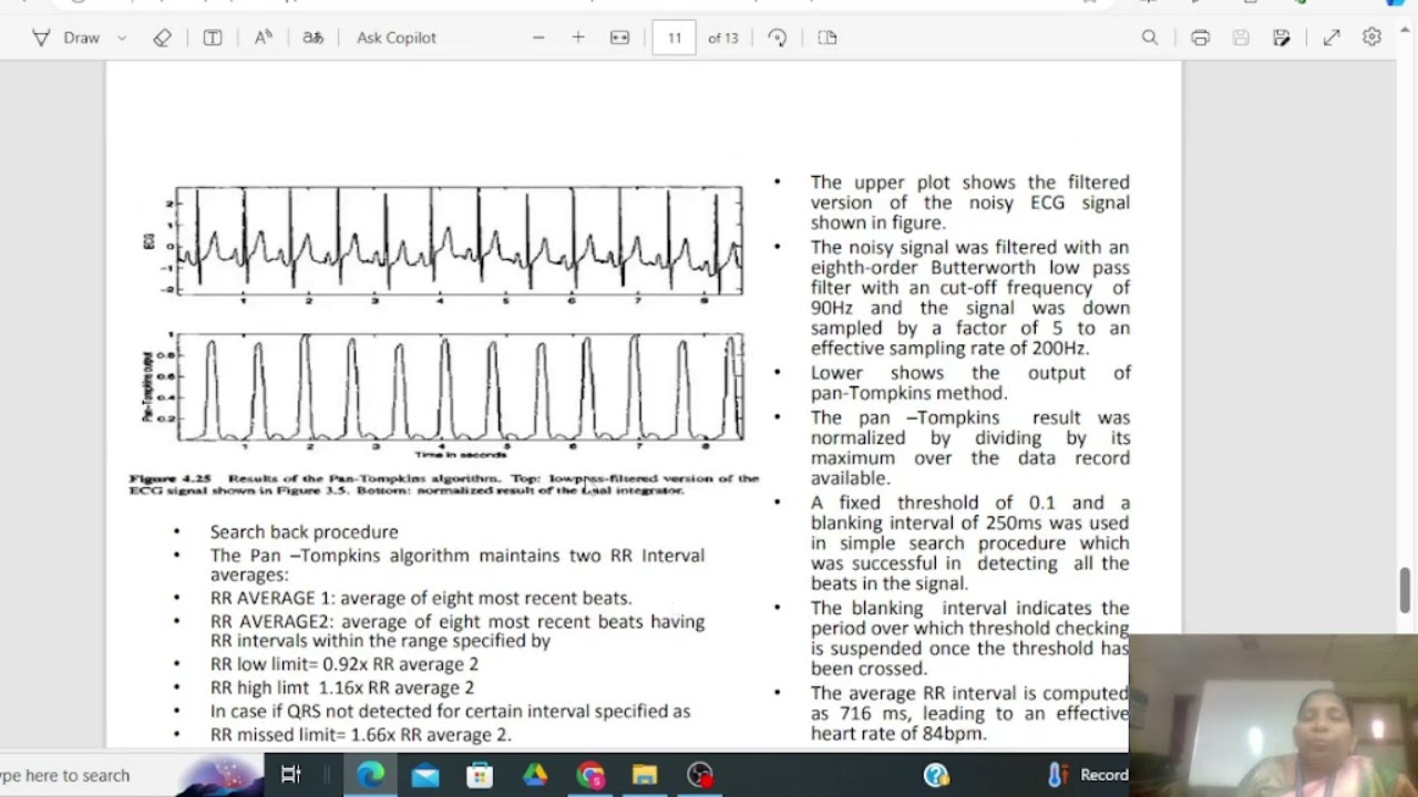 Estimation of RR Interval