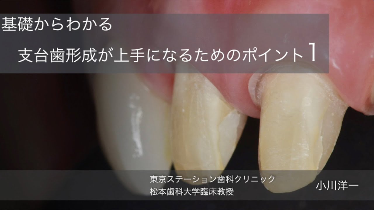 基礎からわかる支台歯形成が上手になるためのポイント1
