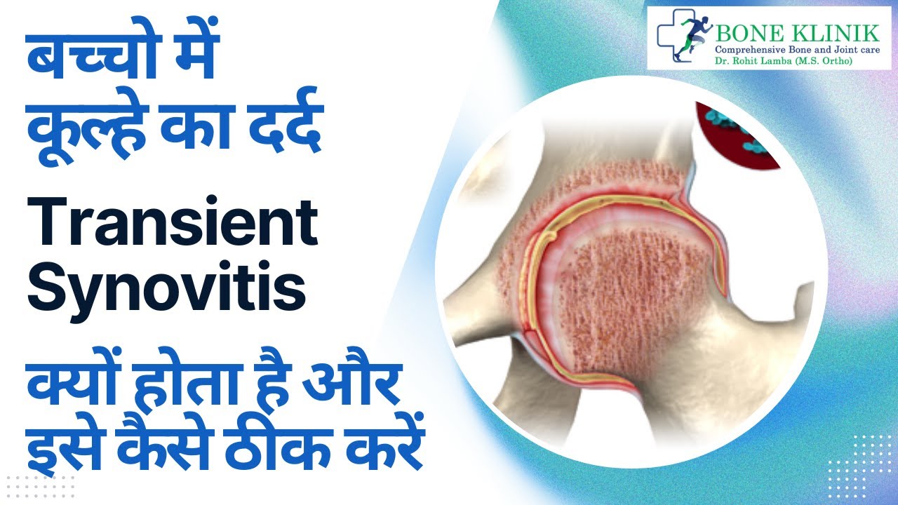 बच्चो में कूल्हे का दर्द Transient Synovitis क्यों होता है और इसे कैसे ठीक करें #transientsynovitis
