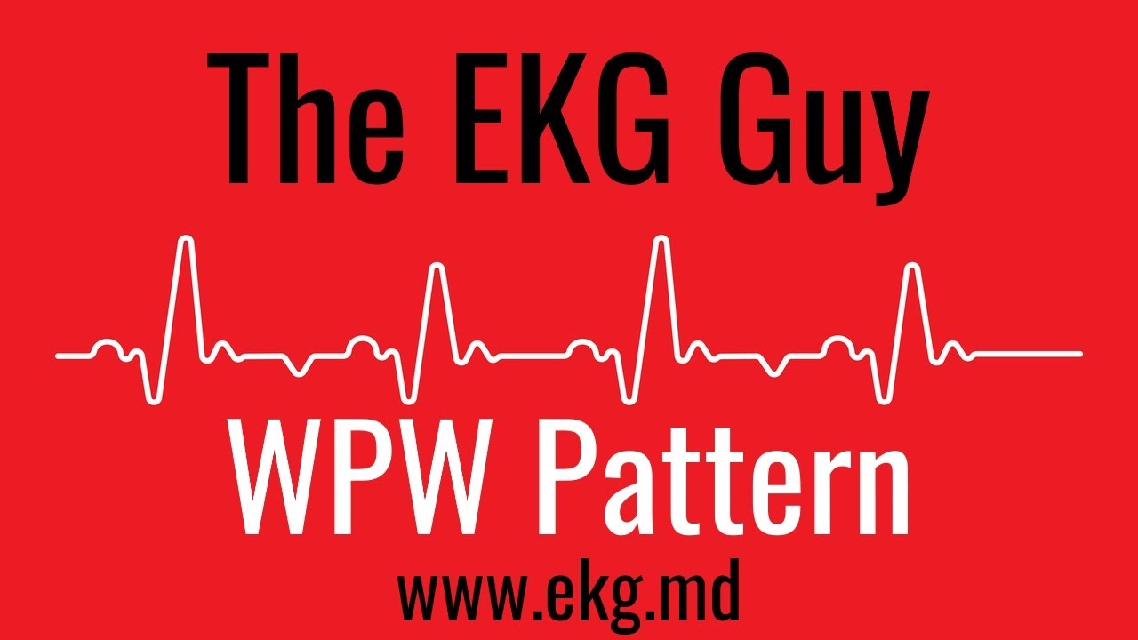 WPW Pattern / Wolff-Parkinson-White Pattern on EKG / ECG  l The EKG Guy - www.ekg.md