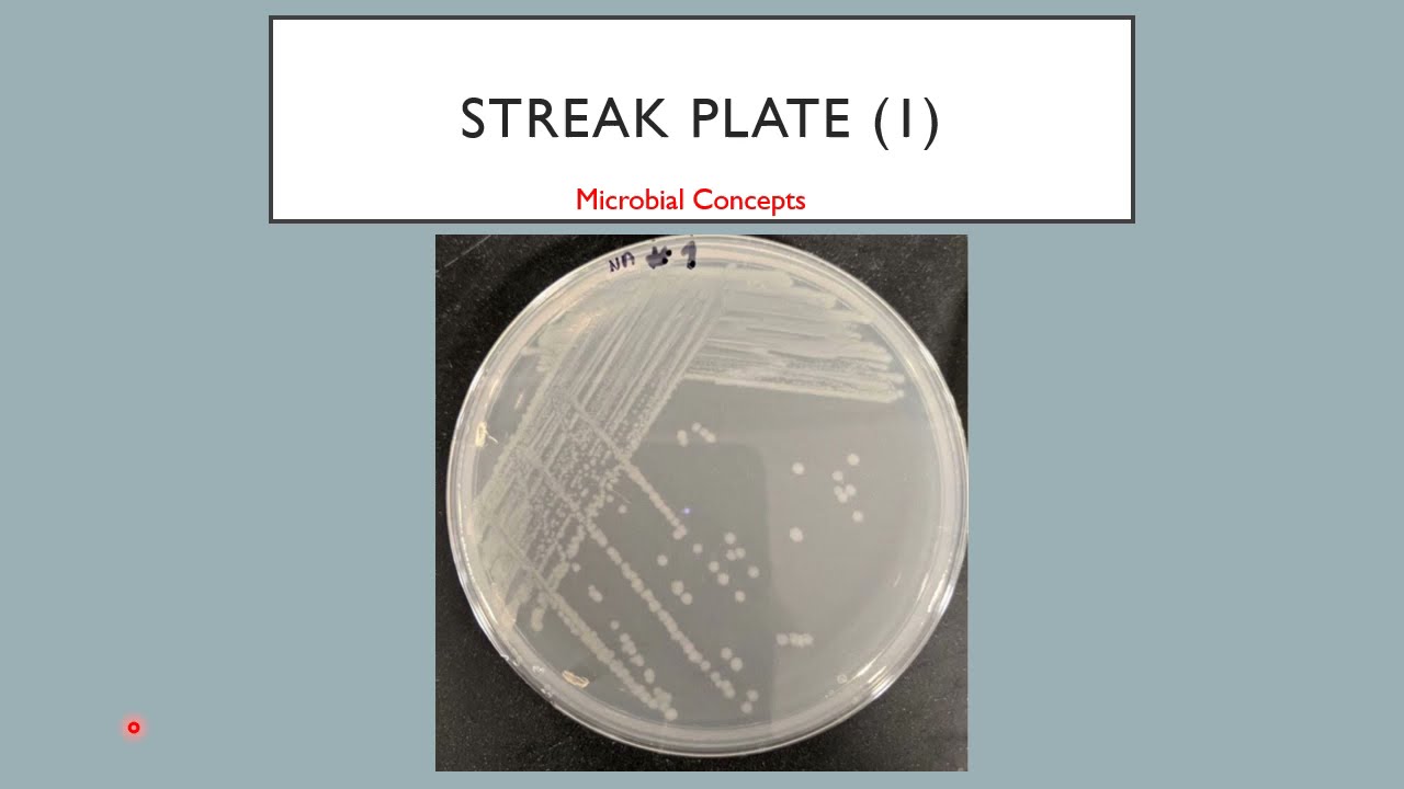 Streak plate 1 | Streaking | Streaking for isolation |Basic microbiology | Microbial Concepts