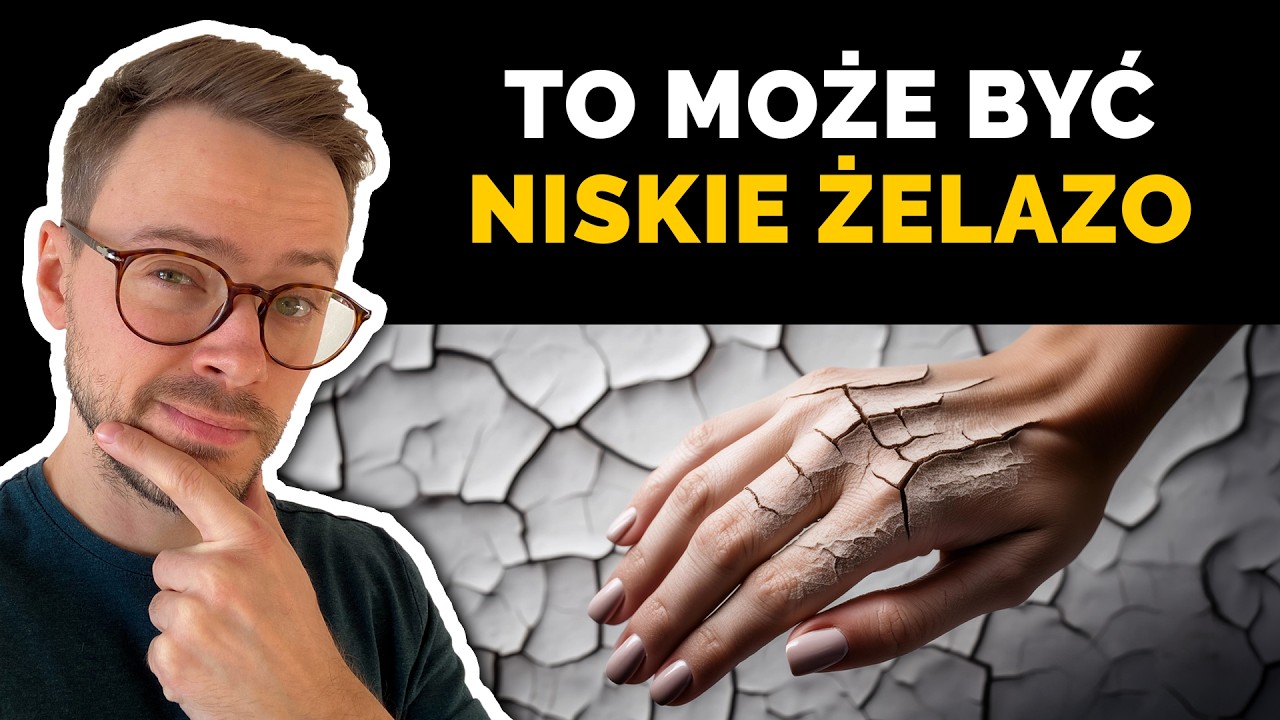 Niedob&oacute;r żelaza i cukrzyca | Jak podnieść żelazo i jakie są objawy niedoboru żelaza? | Nie słodzę