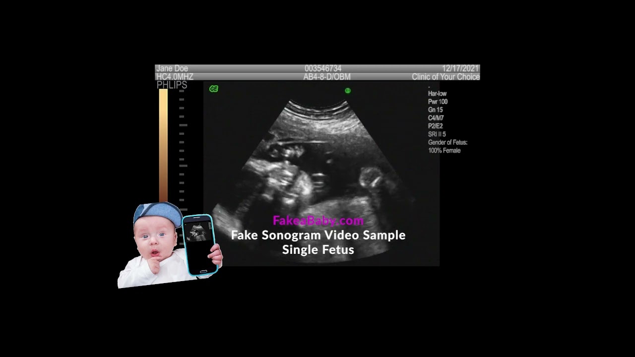 Fake Ultrasound Video of a single fetus, available to customize with your info at www.fakeababy.com!