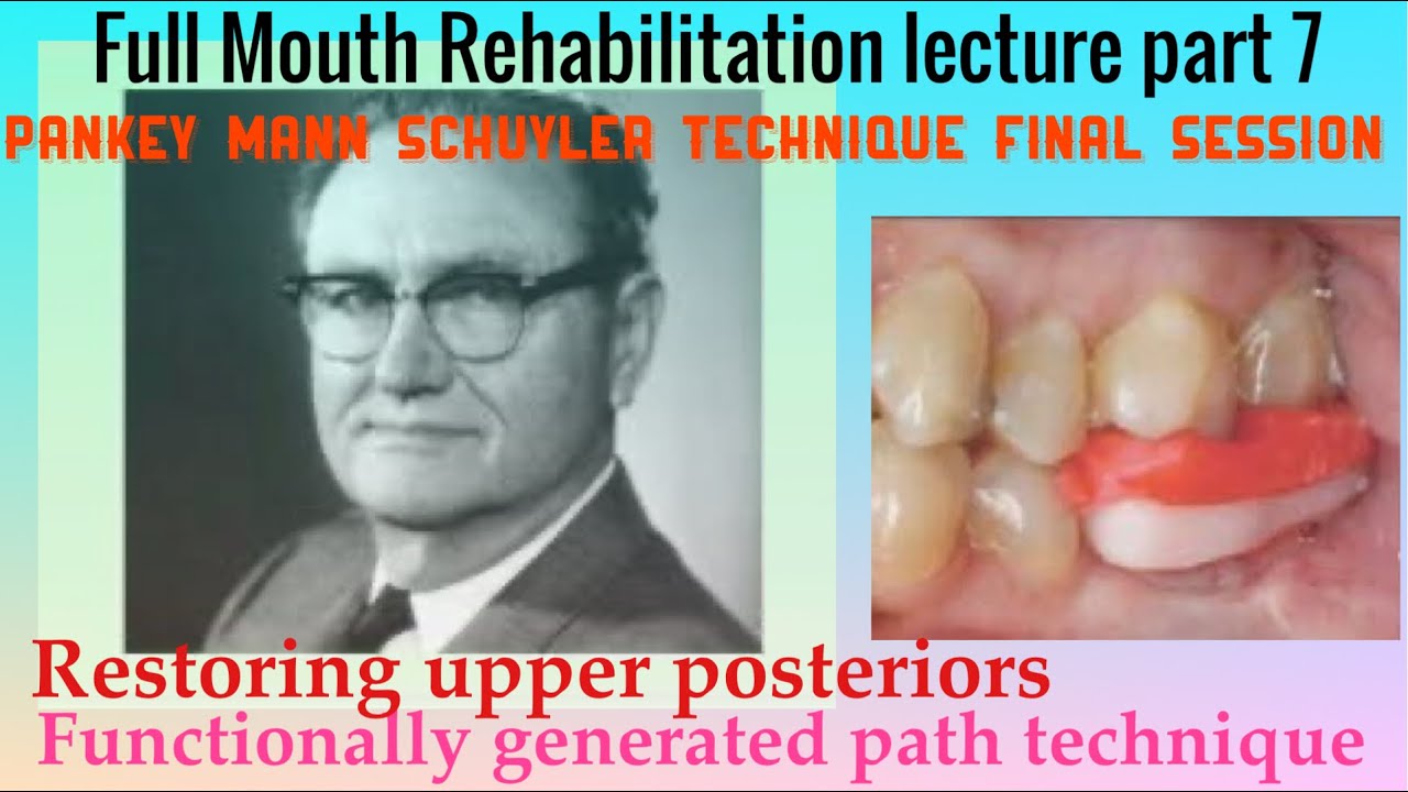 FMR lecture part 7.Final session of Pankey Mann technique.Functionally generated path in detail