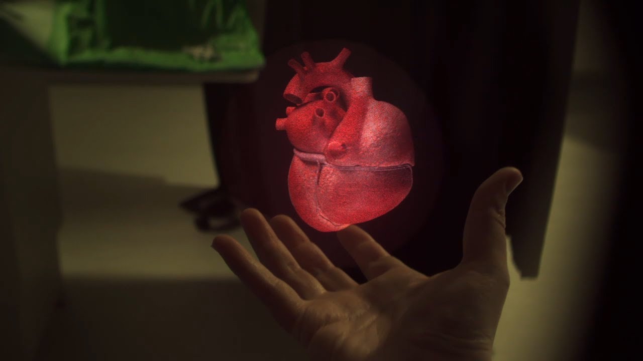 Interactive Live Holography by RealView Imaging - First Ever Medical Holograms