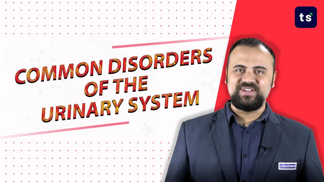 Common disorders of the urinary system | Biology | Kidney | Kidney stone