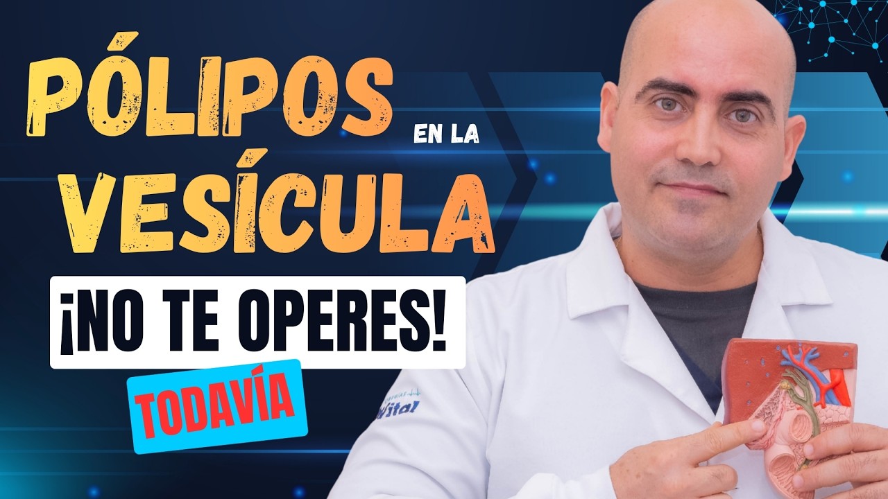 Pólipos en la vesícula biliar: ¿cuándo operar y cuándo solo vigilar? (Guía clara)