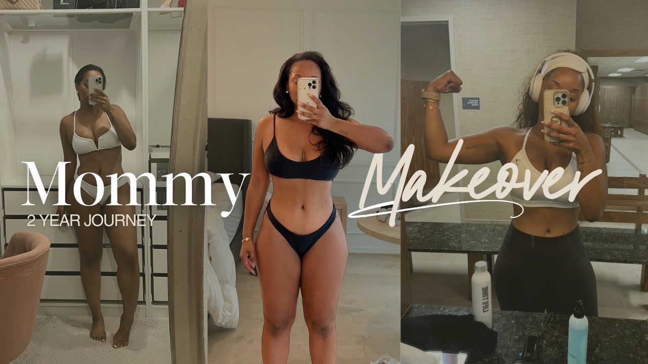 2-Year Mommy Makeover Update | The Highs, Lows & What I’ve Learned
