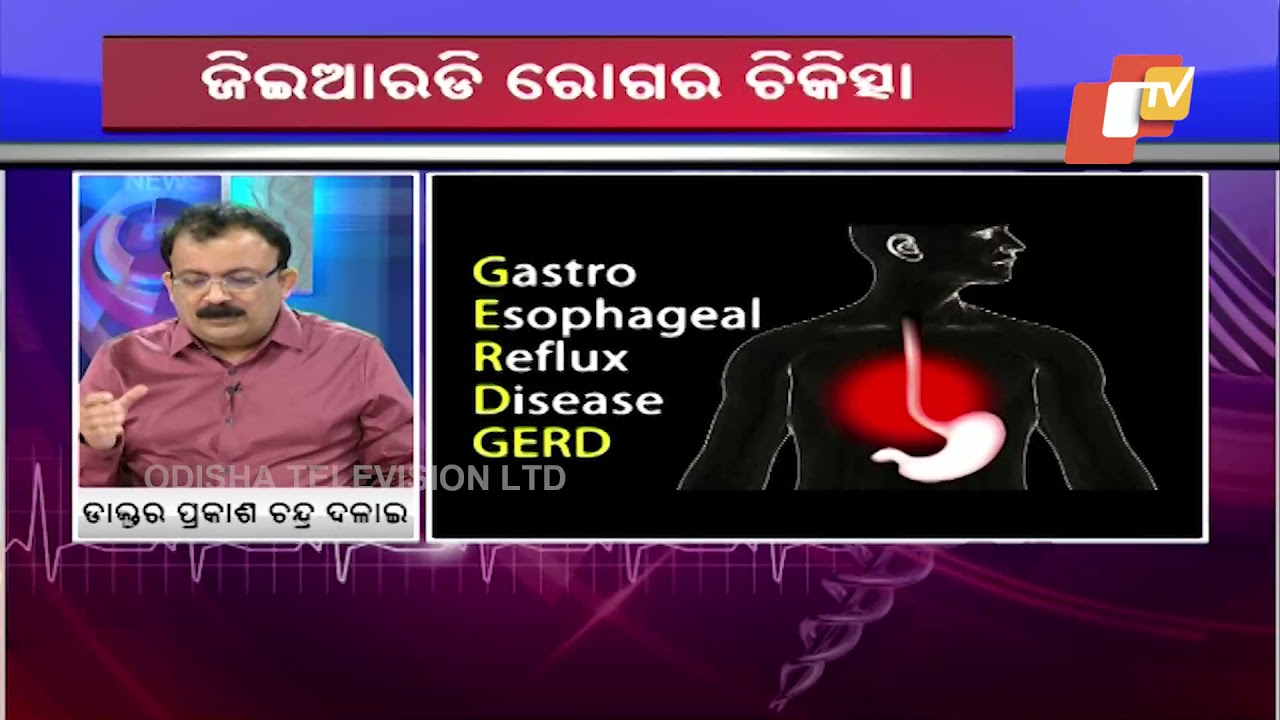 Doctor Doctor | Causes, Symptoms & How To Cure Acidity