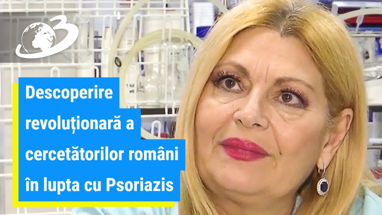 Descoperire revoluționară a cercetătorilor români în lupta cu psoriazis
